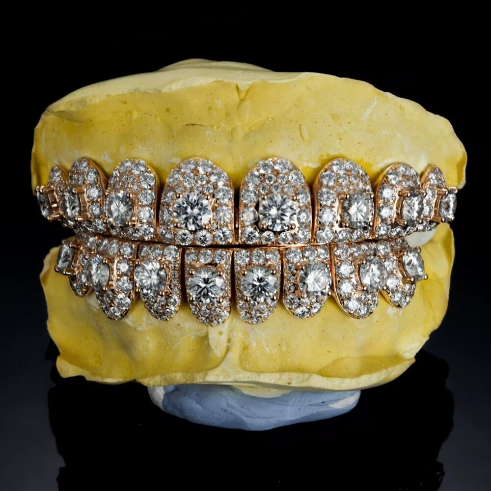 Fully Custom Grillz 1
