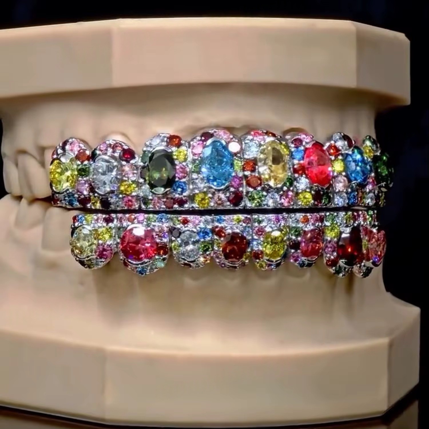 Fully Custom Grillz - Image 3