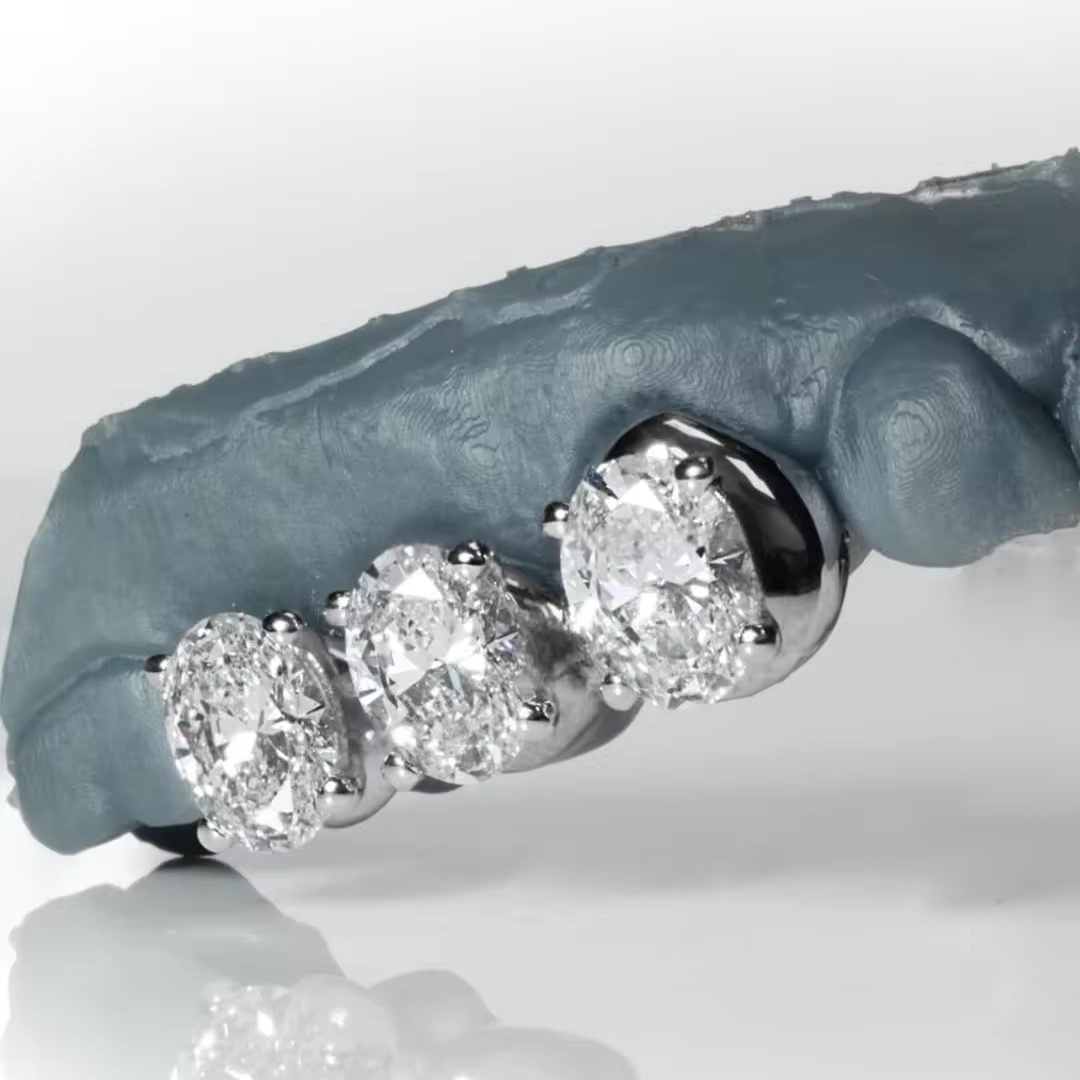 Triple Oval VVS Moissanite Diamond Grillz (White Gold Finish)
