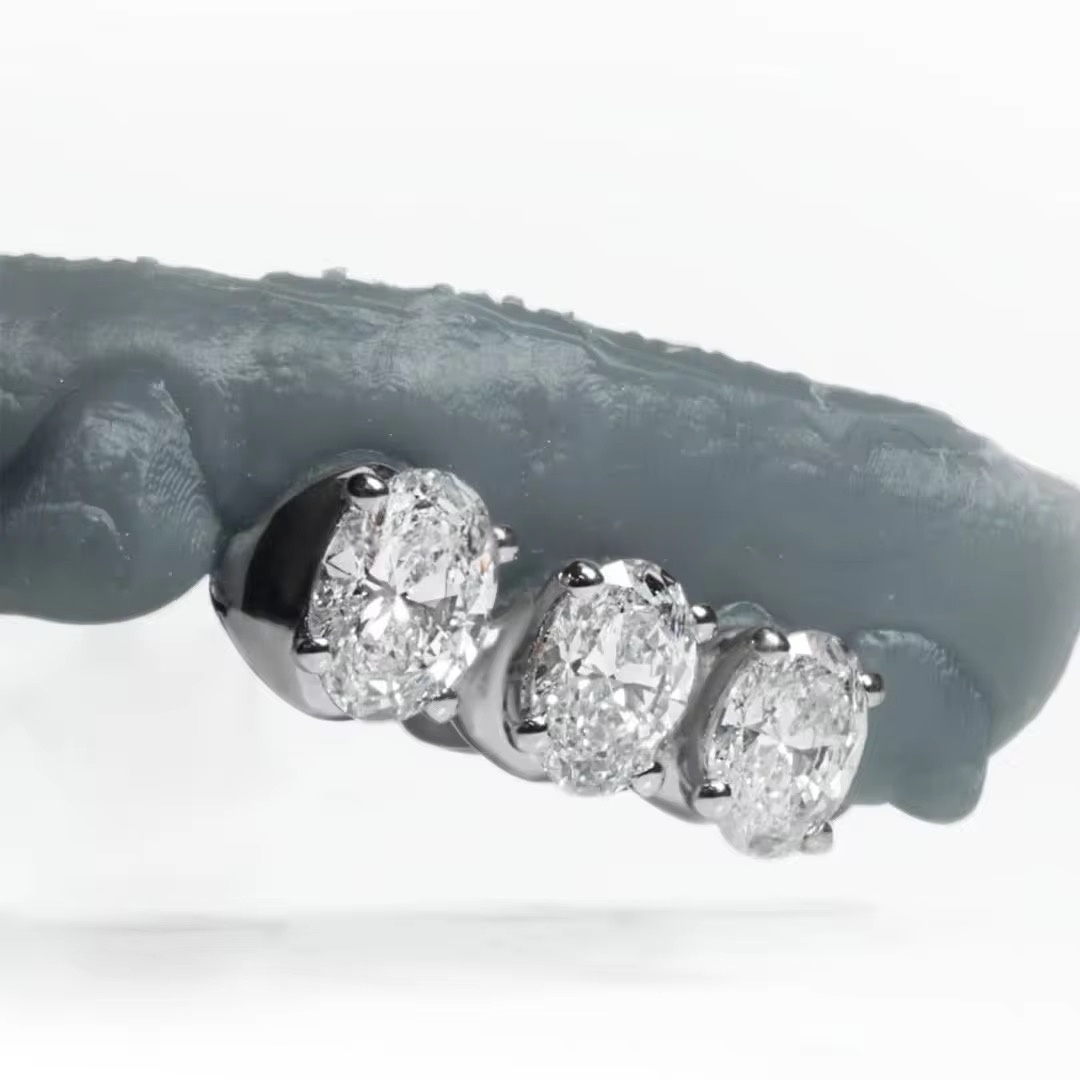 Triple Oval VVS Moissanite Diamond Grillz (White Gold Finish) - Image 2