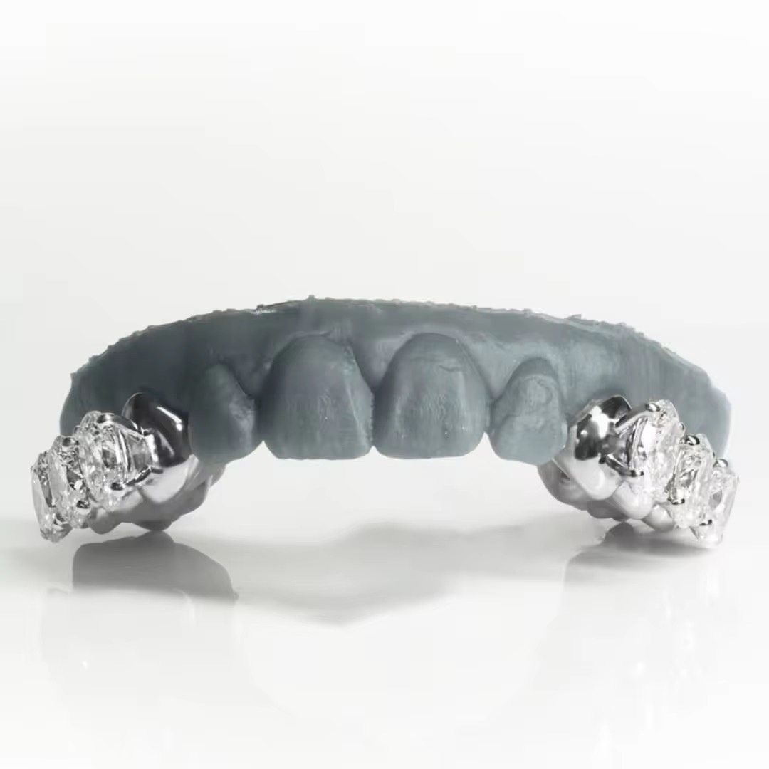 Triple Oval VVS Moissanite Diamond Grillz (White Gold Finish) - Image 3